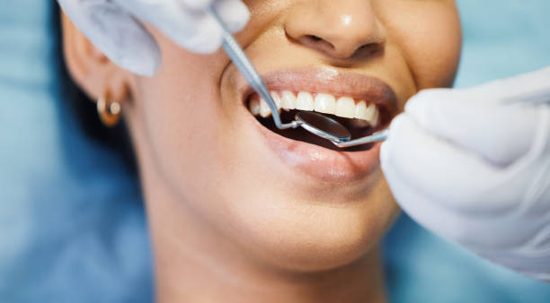 Best Emergency Tooth Extraction in Morgantown, WV